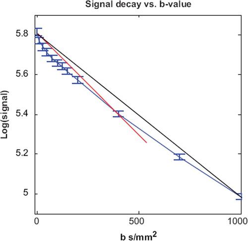 Figure 3. Variation of the apparent diffusion coefficient. The blue line is the signal decay from patient 1. The red line corresponds to an ADC of 0.99 mm2/s obtained by monoexponential fit using b-values 0 and 400 s/mm2. The black line corresponds to an ADC 0.79 mm2/s (b-values 0 and 1000 s/mm2). The diffusion coefficients are overestimated by 48% and 18%, respectively.