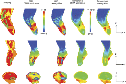Figure 10. Cross sections of the simulated SAR and temperature distributions with CFMA and waveguide applicators. In both cases, the water bath temperature was 42 °C and the absorbed power 200W in tissue and water bath. The colours red, yellow and green in the anatomy represent muscle, fat and bony tissue, respectively and tumour tissue is orange. The small black cross hair indicates the location of the cross sections.