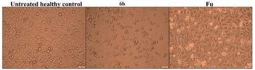 Figure 5. Morphological changes of A549 cells after 72 h treatment with the most active derivative 6b.