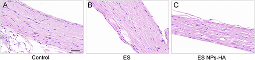 Figure 8 Tissue reactions of ES NPs-HA. HE staining of nerves 14d after treatment with (A) Control: 0.9% NaCl, (B) ES: esketamine, or (C) ES NPs-HA: hydrogel-containing esketamine-encapsulated nanoparticles. Scale bar: 100 μm.