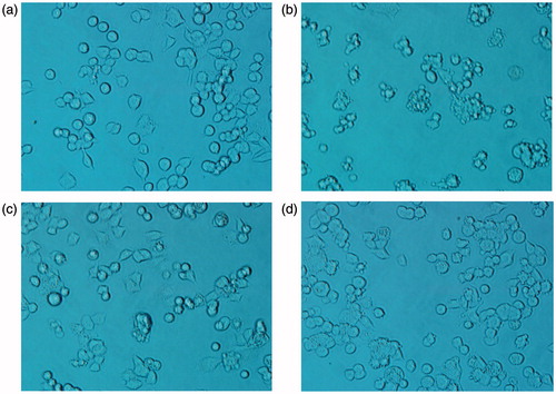 Figure 3. Protective effect of compound 7 on 6-OHDA-induced toxicity. PC12 cells in 6-well plates were pretreated by the tested compound for 3 h. Then cells were treated with 500 μM 6-OHDA for 12 h. Compare untreated control cultures (a) with those treated with 6-OHDA (b) and 6-OHDA plus compound 7 (10 μM; (c)) and (40 μM; (d)). Compound 7 significantly attenuated 6-OHDA-induced toxicity as revealed by the cell states.