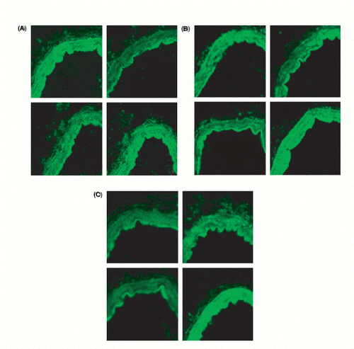 Figure 5. (a) Immunohistochemistry. Left top: AT1 protein expression during normal perfusion pressure (NP) and 1 h. Right top: AT1 protein expression during NP and 17 h. Left bottom: AT1 protein expression during high perfusion pressure (HP) and 1 h. Right bottom: AT1 protein expression during HP and 17 h. (b) Immunohistochemistry. Left top: AT2 protein expression during NP and 1 h. Right top: AT2 protein expression during NP and 17 h. Left bottom: AT2 protein expression during HP and 1 h. Right bottom: AT2 protein expression during HP and 17 h. (c) Immunohistochemistry. Left top: ETB protein expression during NP and 1 h. Right top: ETB protein expression during NP and 17 h. Left bottom: ETB protein expression during HP and 1 h. Right bottom: ETB protein expression during HP and 17 h.