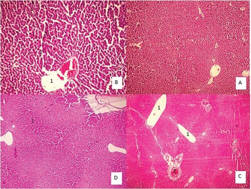 Figure 3. Liver tissue morphology in the rat in acute and sub-chronic period; (A): control group (×100) shows focal necrosis of the liver cells. The lobe of the vein is also seen in the lobular centre. Sinusoids are also dilated and there is no lupus necrosis, (B): One-week exposure (×400) severe necrosis and extensive necrosis of the liver are observed. The necrosis around the portal vein is probably due to the high amount of poison. Complex cells have increased in non-necrotic areas. Sinusoids are also disrupted. The lining of the vein of the lobular system is observed and cells have oedema, (C): 6h exposure (×100), (D): 4 weeks exposure (×100) damage to the liver cells is extensive and from the portal to the venous portal of the lobule centre, but is more intense around the vein of the lobular centre. Fatty change is also observed. Apoptosis and necrosis are observed remarkably in 10% of the liver cells, along with compensatory regenerative changes. The most important lesson of the necrosis of the bridge between the pleasures of the port, which indicates irreversible damage, leads to cirrhosis of the liver.