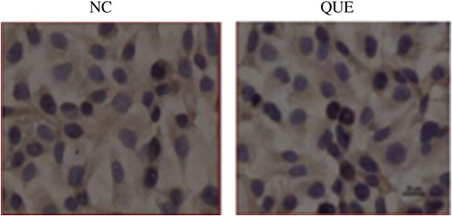 Figure 7. PIAS3 immunocytochemistry in human bladder cancer EJ cell.