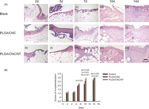 Figure 3. (A) Histological analyses of dorsal skin stained with H&E- staining after full-thickness wounds in diabetic mice. The bar corresponds to 100 μm. (B) The histological scores of the epidermal and dermal regeneration. Results are presented as mean ± SD. #pb PLGA/CNC compared to blank control group, *pb <0.001 NT-loaded PLGA/CNC compared to blank control group, &pb PLGA/CNC compared to NT-loaded PLGA/CNC group.