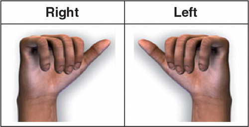 Figure 2. The “worst” hands (right and left) used for anchoring.