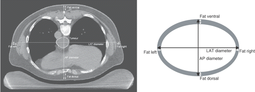 Figure 1. Left: Transversal slice of a CT scan of an oesophageal cancer patient, made in treatment position, i.e. in prone position on a water bolus. The tumour was outlined by a radiation oncologist. The dorsoventral (AP) and lateral (LAT) diameters, as well as the thickness of the dorsal, ventral, left and right fat layers were measured at mid-tumoural level. Right: Schematic drawing of the patient's cross section based on the diameters and fat layer thickness as determined from the CT scan, used to estimate the fat percentage.