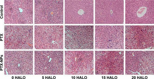 Figure 7 Liver damage after PTX-NPs treatment of A549-transplanted null mice at 0, 5, 10, 15, and 20 HALO (400×).Abbreviations: HALO, hours after light onset; PTX, paclitaxel; PTX-NPs, paclitaxel nanoparticles.