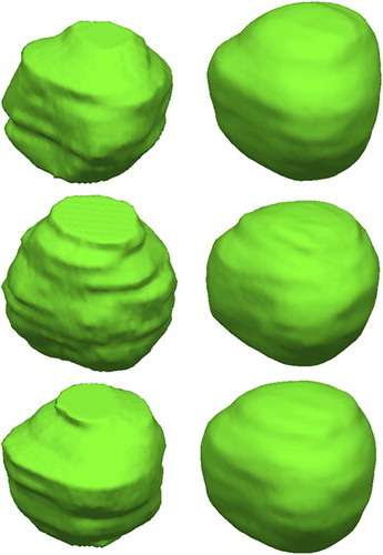 Figure 2. Examples of the prostate segmentation. Left: The reference manual segmentation. Right: Automated 3D segmentation.