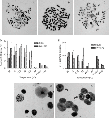 Figure 1. (A–C) Typical examples of S-phase (A), G2-phase (B) and G1-phase (C) PCC in SW-1573 cells. Magnification: 1,000 x. (D) Total PCC induction, and (E) induction of PCC in G1 and G2 phase cells by Cal in cells immediately after hyperthermia treatment at various temperatures for 1 h and in thermotolerant (TT) cells treated at the indicated temperature. Means with standard errors of three independent experiments. (F–G) Representative examples of SW-1573 nuclei after incubation of cells with Cal for 1 h to induce PCC. (F) untreated cells: two G2 phase PCC spreads and 6 non-condensed nuclei are visible, and (G) cells treated with 43°C hyperthermia (1 h), arrows: condensation of nuclei not resulting in chromosomal spreads. Magnification: 200 x.