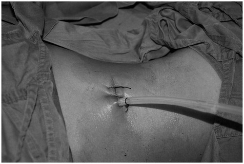 Figure 5. Appearance of the incision site post operation.