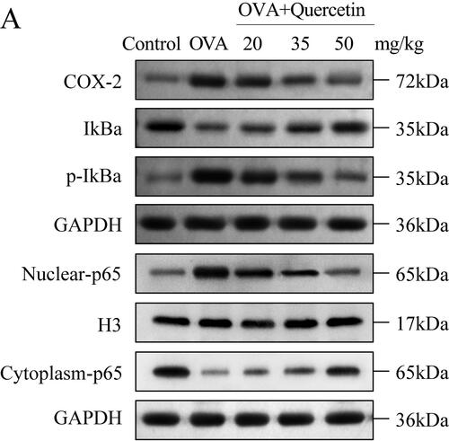 Figure 7. Quercetin inhibits OVA-induced activation the NF-κB pathway. The protein levels of the NF-κB pathway including COX-2, IkBα, p-IkBα, nuclear-p65, cytoplasm-p65 were measured using western blot. GAPDH was the internal control. H3 was the internal control of nuclear-p65.