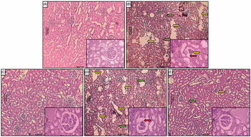 Figure 3. Effect of berberine on GM-induced alterations in kidney histology in rats. Photomicrograph of sections of the kidney of normal (A), GM-control rats (B), methylprednisolone (12.5 mg/kg)-treated rats (C), berberine (20 mg/kg) treated rats (D), and berberine (40 mg/kg) treated rats (E). Necrosis (Yellow arrow), inflammatory infiltration (Green arrow) and increased thickness of basement membrane (Red arrow) H & E staining at 40× and 100 × (inset).