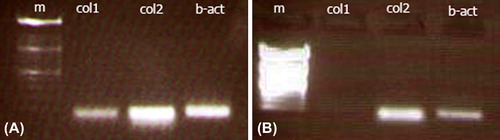Figure 3. Agarose gel documentation PCR analyses of collagen type I and collagen type II. A. A strong collagen type II band and a weaker collagen type I bands were expressed until the 8th day of the culture. The gel picture belonged to the chondrocyte seeded scaffolds devoid of catechin at the 5th day. B. The collagen type I band was no longer at the 14th day. The gel picture belonged to the chondrocyte-seeded scaffolds loaded with catechin at the 14th day. M = DNA marker; col1 = collagen type I, col2 = collagen type II; b-act = β2-microglobulin.