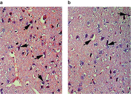 Figure 7. Nissl-stained neurons in the neuropil of cerebral cortex in pigs treated with vasopressin and adrenaline in combination (VA group) (a) or vasopressin alone (b). Vasopressin alone caused less neuronal damage, sponginess, and edema up to a certain extent in pigs after cardiac arrest, while several neurons were damaged with perineuronal edema in the group given combined treatment with vasopressin and adrenaline (VA group). ×300.
