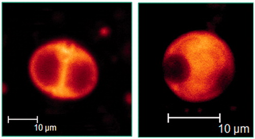 Figure 6. Confocal laser scanning micrographs of discomes (left) and conventional spherical niosomes (right) loaded with carboxyfluorescein (Abdelkader et al., 2012b).