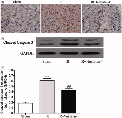 Figure 5. Effects of nesfatin-1 on I/R-induced caspase-3 expression at 24 h after reperfusion. (A) Representative photomicrographs of immunohistochemical-stained kidney sections for cleaved caspase-3 (magnification × 400). (B) Representative western blots of cleaved caspased-3. (C) Quantitative analyses of the band density of cleaved caspased-3 (relative to GAPDH). **p < 0.01 versus the sham group and ##p < 0.01 versus the I/R group.