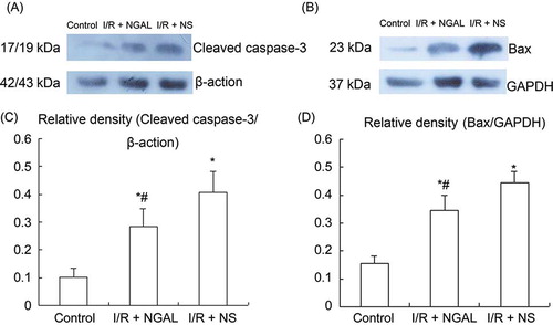 Figure 4.  Western blot analysis of Cleaved caspase-3 and Bax in renal tubular epithelial cells. Representative immunoblots of Cleaved caspase-3 (A) and Bax (B). Densitometric quantification of Cleaved caspase-3 (C) and Bax (D). Note: *p < 0.05 versus control group, #p < 0.05 versus I/R + NS group. Data are mean ± standard deviation (SD) for n = 6 animals per group.