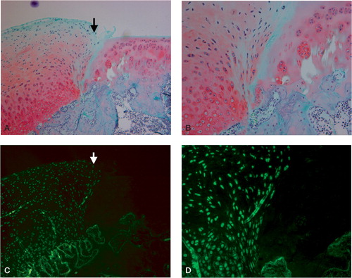 Figure 3. Typical light microscopic appearance (A, B) and fluorescent microscopic appearance (C, D) at 4 weeks after surgery.The arrow indicates the borderline between the repaired tissue and normal cartilage. The left side is repaired tissue. A. The defect is filled with the regenerated tissue that has been well stained by safranin-O.The regenerated cartilage-like tissue reaches over the level of the surrounding articular cartilage (safranin-O, × 100). B. The deep layer of the regenerated tissue has chondrocyte-like cells that are surrounded by a well-stained matrix, and the superficial layer of the regenerated tissue contains fibroblast-like cells.The regenerated cartilage-like tissue integrates well with the surrounding tissue (safranin-O, × 200). C. and D.Most cells in the regenerated tissue are GFP-positive cells derived from the donor periosteum in the superficial, middle, and deep region of the defect (C: × 100, D: × 200).