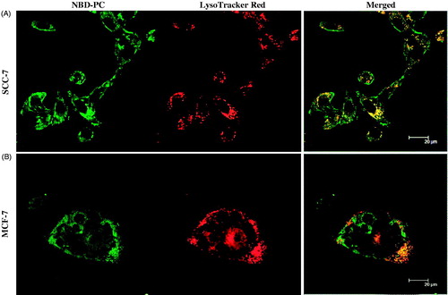 Figure 7. Intracellular uptake of NLCs in (A) SCC-7 cell, and (B) MCF-7 cells. NLCs contain NBD-PC (green) as a fluorescent probe. The LysoTracker Red stained for lysosome (red).