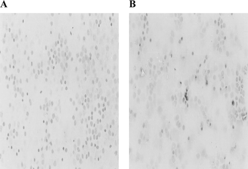FIG. 1 Induction of apoptosis in White Leghorn lymphocytes treated with 10−5 M deltamethin in vitro. Photomicrographs (at X400) are of avian lymphocytes after immunoperoxidase staining to detect presence of Annexin-V (A) Control lymphocytes. (B) Lymphocytes treated with deltemethrin with translocated phosphatidylserine on their surface.