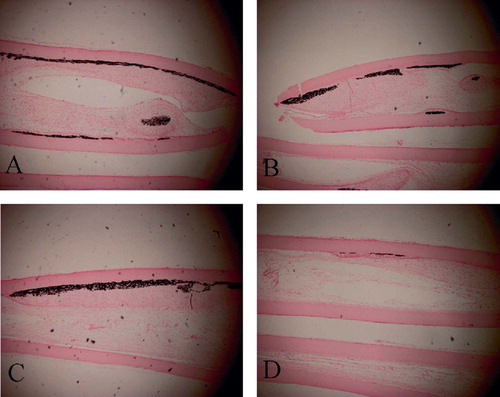 Figure 5. Photomicrographs of histological sections of the diffusion chambers with the BMP(+) group from passages P1(A), P2(B), P3(C), and P4(D) at 4 weeks after implantation. Abundant calcium depositions at the membrane were observed in cells from passages P1–P3. (Von Kossa staining; original magnification 100×).