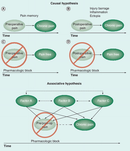 Figure 1. Causal (top) and associative (bottom) hypotheses predicting the prevention and nonprevention of chronic postsurgical pain by pharmacologic blockade at various times throughout the perioperative period.Top: transition to chronicity (A,B) may be prevented by pharmacological blockade of preoperative pain (C) and/or acute postoperative pain (D) assuming preoperative or acute postoperative pain are the causes of chronic postsurgcial pain. Bottom: transition to chronicity will not be prevented if pains are merely associated and caused by one or more inter-related factors. post-op: Postoperation.