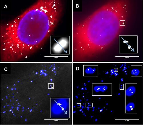 Figure 6 Sensitivity of Confocal Reflectance Microscopy (CRM) and Reflectance Structured Illumination Microscopy (R-SIM). HeLa cells were treated with cerium dioxide NPs. (A) CRM and (B) R-SIM show cytoplasmic stain (CTDR, red), nuclear stain (DAPI, blue) and NP signal (grey). Overlay of the cerium dioxide NP regions show particles detected in CRM (blue) and SIM (grey) in both the raw (C) and processed (D) images. White boxes display a sample of regions where CRM detects one spot and SIM detects multiple spots, illustrating the enhanced resolution of SIM. Reproduced from Guggenheim EJ, Khan A, Pike J, Chang L, Lynch I, Rappoport JZ. Comparison of Confocal and Super-Resolution Reflectance Imaging of Metal Oxide Nanoparticles. PLoS One. 2016;11(10):e0159980. © 2016 Guggenheim et al. This is an open access article distributed under the terms of the Creative Commons Attribution LicenseCitation181.