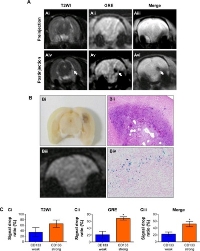 Figure 6 In vivo labeling of USPIO-CD133 Ab in ENU-induced rat brain tumors.Notes: (A) Hypointensity of MRI signals after intravenous injection of USPIO-CD133 Ab. In T2 weighted images (Ai and Aiv), multiecho GRE images (Aii and Av), and Merge images (Aiii and Avi), MRI signals significantly decreased (white arrow) before (Ai–Aiii) and after (Aiv–Av) injection of USPIO-CD133 Ab for 24 hours. (B) USPIO-CD133 Ab decreased the signals of magnetic resonance (MR) imaging in ENU-induced rat brain tumors. (Bi) Gross view. (Bii) H&E staining at 100× magnification. (Biii) Multiple echo recombined gradient echo (Merge) image. (Biv) Prussian blue staining at 200× magnification in ENU-induced rat brain tumors. (C) The representative signal drop ratio of MR images, including T2WI (Ci), multiecho GRE images (Cii), and Merge images (Ciii) after USPIO-CD133 Ab injection. Bar, SE; *P<0.05.Abbreviations: ENU, N-ethyl-N-nitrosourea; H&E, hematoxylin and eosin; GRE, gradient-echo; Merge, multiple echo recombined gradient echo; SE, standard error of the mean; T2WI, T2 weighted image; USPIO-CD133 Ab, ultrasmall superparamagnetic iron oxide conjugated with anti-CD133 antibodies.