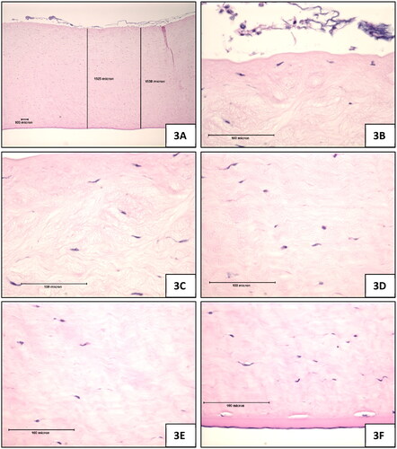 Figure 3. Test Substance (laundry detergent, neat), 10-min exposure, 120-min post-exposure. (A) Full thickness view of the cornea which was appreciably thicker than the negative control treated corneas, magnification 42x (B) Epithelium was lost in all sections, magnification 420x (C) Stroma directly beneath the anterior limiting lamina showing marked stromal swelling, and keratocyte degeneration, magnification 420x (D) Stroma near mid depth showing marked stromal swelling and moderate keratocyte enlargement, magnification 420x (E) lower stroma showing moderate collagen swelling without an appreciable increase in keratocyte changes, magnification 420x (F) Endothelium was generally intact, magnification 420x.