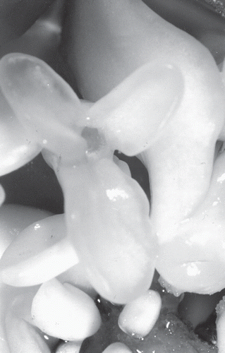Figure 1.  Horse chestnut androgenic embryo at the cotyledonary stage of development cultured on MS solid phytoregulator-free medium.