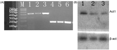 Figure 1. Act1 mRNA expressed in synovioblast cells and SW982 cells. (A) Gel image of RT-PCR product for Act1 mRNA. Lines 1, 2: Act1 mRNA (415 bp) in primary cultured RA fibroblast-like synovial cells; line 3: Act1 mRNA in SW982 cells; lines 4–6: β-actin mRNA (220 bp) in SW982 cells; M: Trans DNA Marker I. (B) Representative Western blot bands of Act1 and β-actin are shown. Line 1: SW982; lines 2–3: primary cultured RA fibroblast-like synovial cells.