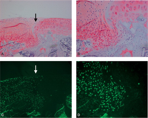 Figure 4. Typical light microscopic appearance (A, B) and fluorescent microscopic appearance (C, D) at 8 weeks after surgery.The arrow indicates the borderline between the repaired tissue and normal cartilage.The left side is repaired cartilage. A. The defect is repaired with regenerated cartilage-like tissue which integrates well with the surrounding normal cartilage (safranin-O, × 100). B. The deep layer of the regenerated tissue also has chondrocyte-like cells that are surrounded by a well-stained matrix (safranin-O, × 200). C. and D.Most cells in the regenerated tissue are GFP-positive cells derived from the donor periosteum in the superficial, middle, and deep region of the defect (C: × 100, D: × 200).