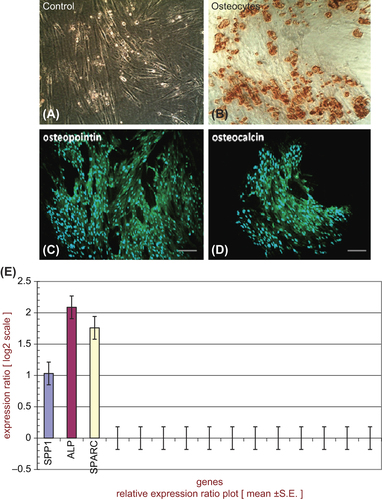 Figure 9. Osteogenic capacity under in vitro condition (A, B), immunocytochemistry for osteocyte special marker osteopontin (C) and osteocalsin (D) [Scale bar: 100 μm], evaluation of gene expression of critical genes (SPP1, ALP, SPARC) for osteoconductivity by Real time PCR in 3D culture condition (E).