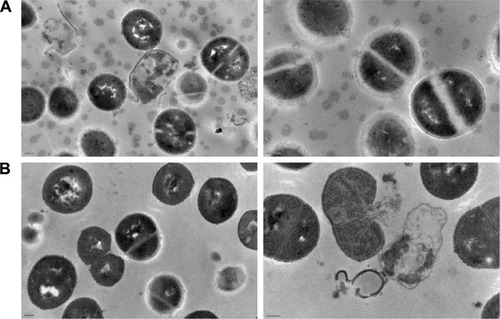 Figure 6 Transmission electron microscope images of MSSA ATCC 25923 strain treated with 128 µg/mL (32× MIC) of AP114 (A) and 64 µg/mL (32× MIC) of AP138 (B) for 1 hour. Scale bars: (A) left: 0.2 µm, right: 100 nm; (B) left: 0.2 µm, right: 200 nm.Abbreviations: MIC, minimum inhibitory concentration; MSSA, methicillin-susceptible Staphylococcus aureus.
