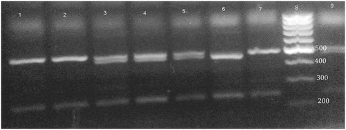 Figure 1. XPD 312 genotypes on ethidium bromide stained 3% agarose gel. Lanes 1, 2 and 7 are homozygous Asp/Asp genotype. Lanes 3, 4, 5 and 9 are heterozygous Asp/Asn genotype. Lane 6 is homozygous Asn/Asn genotype. Lane 8 is 100 bp ladder.