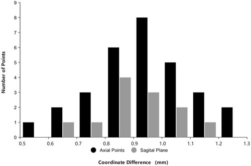 Figure 7 Histogram of coordinate differences between US images and registered CT images in the axial plane (black columns) for 30 markers and the sagittal plane (grey columns) for 12 markers.