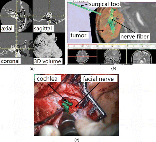 Figure 7 The display methods for image guided surgery; (a) multi-planar, (b) 3-D graphic, (c) augmented reality mode (color figure available online).