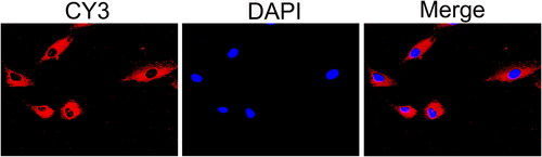 Figure 3. LncRNA OIP5-AS1 is localised in the cytoplasm according to the FISH assay.