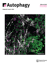 Cover image for Autophagy, Volume 20, Issue 8