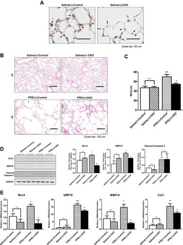 Figure 4 The selective deletion of Rcn3 in AECIIs alleviated elastase-induced emphysema. (A) IHC assays of Rcn3 from lungs in saline-treated WT mice or saline-treated CKO mice (arrows indicate the corners of alveoli, suggestive of AECIIs). Bar size: 50 μm; (B) H&E staining of lung tissues from mice in Saline(+)-Control, Saline(+)-CKO, PPE(+)-Control and PPE(+)-CKO groups. Bar size: 100 μm; (C) The MLI analysis of lung sections from the four groups of mice (46.85 ± 3.56 μm, 47.45 ± 2.268 μm, 70.07 ± 5.067 μm, and 54.34 ± 1.977 μm, respectively, n = 9–10 per group); (D) The protein levels of Rcn3, GRP78 and Cleaved caspase-3 in Saline(+)-Control, Saline(+)-CKO, PPE(+)-Control, and PPE(+)-CKO mice were examined by Western blot analysis and the ratios to GAPDH presented by bar graph, n = 5 per group; (E) Qualitative PCR analysis of the mRNA expressions of Rcn3, GRP78, MMP-9, and Collagen I in Saline(+)-Control, Saline(+)-CKO, PPE(+)-Control, and PPE(+)-CKO mice, n = 5 per group. Data presented as mean ± SEM; *p<0.05, **p<0.01, ***p<0.001, versus Saline(+)-Control group; #p<0.05, ##p<0.01, versus PPE(+)-Control group.