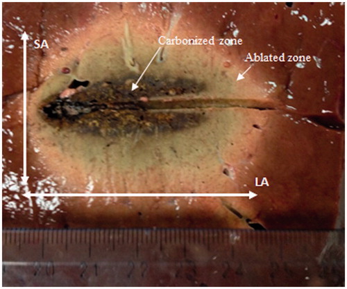 Figure 1. Appearance of the thermally ablated area after a microwave thermal ablation (MTA) procedure performed in ex vivo bovine liver.