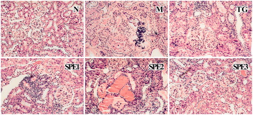 Figure 5. Light micrographic changes of the kidney specimens (stained with HE, 10 × 20). N: normal control group; M: model group; TG: control medicine group (15 mg/kg TG i.g.); SPE1: low dose treatment group (50 mg/kg SPE i.g.); SPE2: medium dose treatment group (100 mg/kg SPE i.g.); SPE3: high dose treatment group (200 mg/kg SPE i.g.).