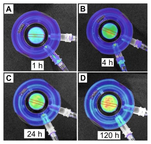 Figure 6 Bioluminescence images of bone with inserted drug-releasing implant (based on a titanium wire with titania nanotube arrays on the surface) for local drug delivery: distribution of released model drug (rhodamine B) taken at (A) 1, (B) 4, (C) 24, and (D) 120 hours (h) using the Xenogen IVIS® 100 (Caliper Life Sciences, Inc, Hopkinton, MA) in vivo imaging system.