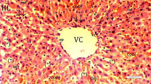 Figure 3 Representative light microscopy of hepatic tissue from the ischemia-reperfusion group.