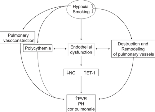 Figure 1 Pathophysiology of cor pulmonale in COPD.