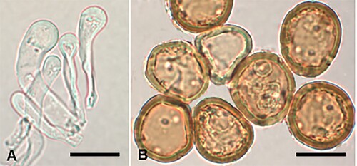 Figure 11. Puccinia gaudichaudianae on Carex gaudichaudiana: A, Uredinial paraphyses. B, Urediniospores. Scale bars = 20 μm.