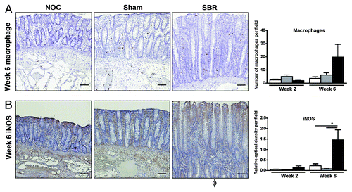 Figure 4. There is an increase in inflammatory cells and mediators in the colonic epithelium following small bowel resection. There was an increase in the number of macrophages (A) and the percentage of cytoplasmic inducible nitric oxide synthase (iNOS) staining (B) in the colonic epithelium six weeks post-surgery. Immunohistochemistry images illustrate representative staining six weeks post-surgery. Scale bar represents 100 µm. Values are expressed as mean ± SEM; n = 5−6/group.