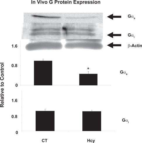 Figure 1 In vivo G protein content of Gs and Gi in wild type and CBS KO mice. β-actin was used as a standard for both protein samples. Gs content in CBS KO mice was reduced to 46% (P < 0.01, n = 4) that of control values based on 3 different tissue homogenates. Pixel intensity was digitized using UnScanIt Software.
