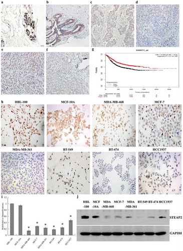 Figure 1. Expressions of STEAP2 in breast tissues and cell lines and its Kaplan-Meier plotter analysis. STEAP2 expressions of (a) normal human breast tissue, (b) fibroadenoma tissue, (c) well differentiated invasive ductal carcinoma, (d) poorly differentiated invasive ductal carcinoma, (e) well differentiated invasive lobular carcinoma and (f) poorly differentiated invasive lobular carcinoma were measured by IHC. (Magnification×200). (g) Analysis of the public Kaplan-Meier plotter database of breast cancer, patients with high STEAP2 expression (red line) had a much better prognosis than those with low STEAP2 expression (black line). STEAP2 expressions of breast epithelial cell line HBL-100 and MCF-10A, and 6 kinds of cancer cell lines (MDA-MB-361, HCC1937, MDA-MB-468, MCF-7, BT-549 and BT-474) were measured by (h) ICC staining, (i) real time RT-qPCR and (j) western blotting (cropped blot). MDA-MB-468, MCF-7 and MDA-MB-361 are breast adenocarcinoma cell lines, meanwhile, BT-549, BT-474 and HCC1937 are breast ductal cancer cell line, both of which had lower expressions of STEAP2, compared to normal breast epithelial cell lines HBL-100 and MCF-10A. (Magnification×200). *P < .05.